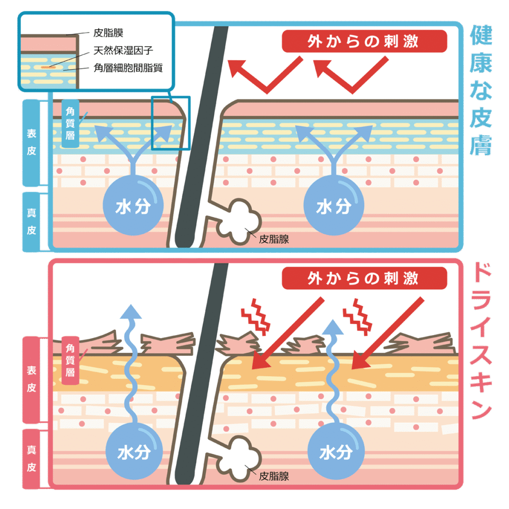 健康な肌とドライスキンの比較図